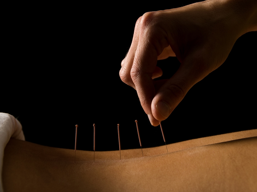 Getting poked for healthy reasons