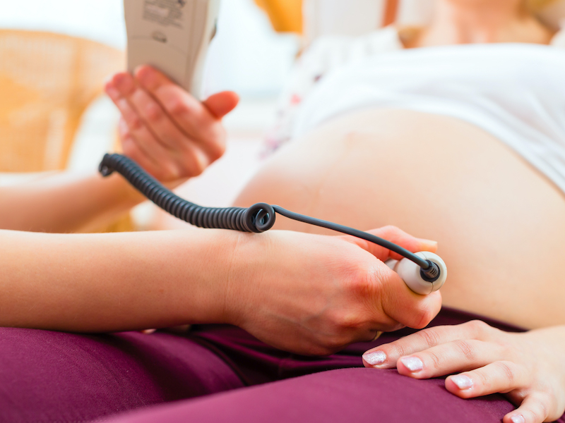 midwifery and a midwives role