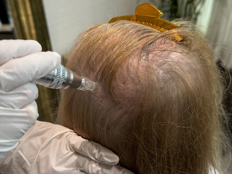 best hair growth serum for women